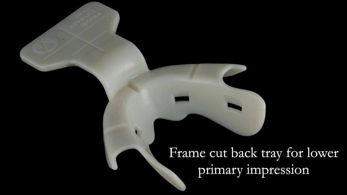Fin’s Newsletter 88 — Complete dentures - full protocol… he rearranged his own teeth!