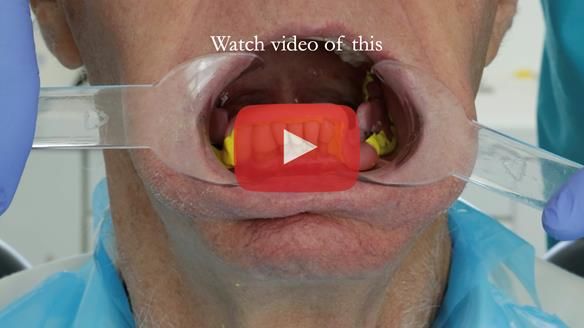 Ken – going downhill, first class