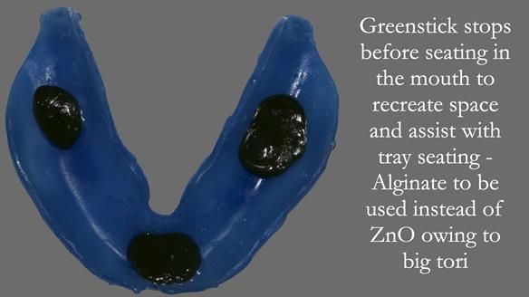 Newsletter 53 showing the making and fitting of ultra life-like dentures for Valena