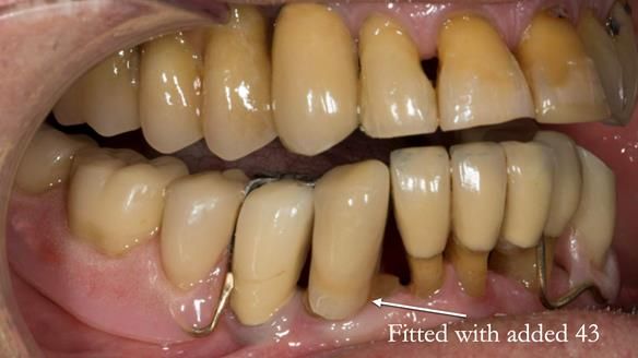 Ken – going downhill, first class