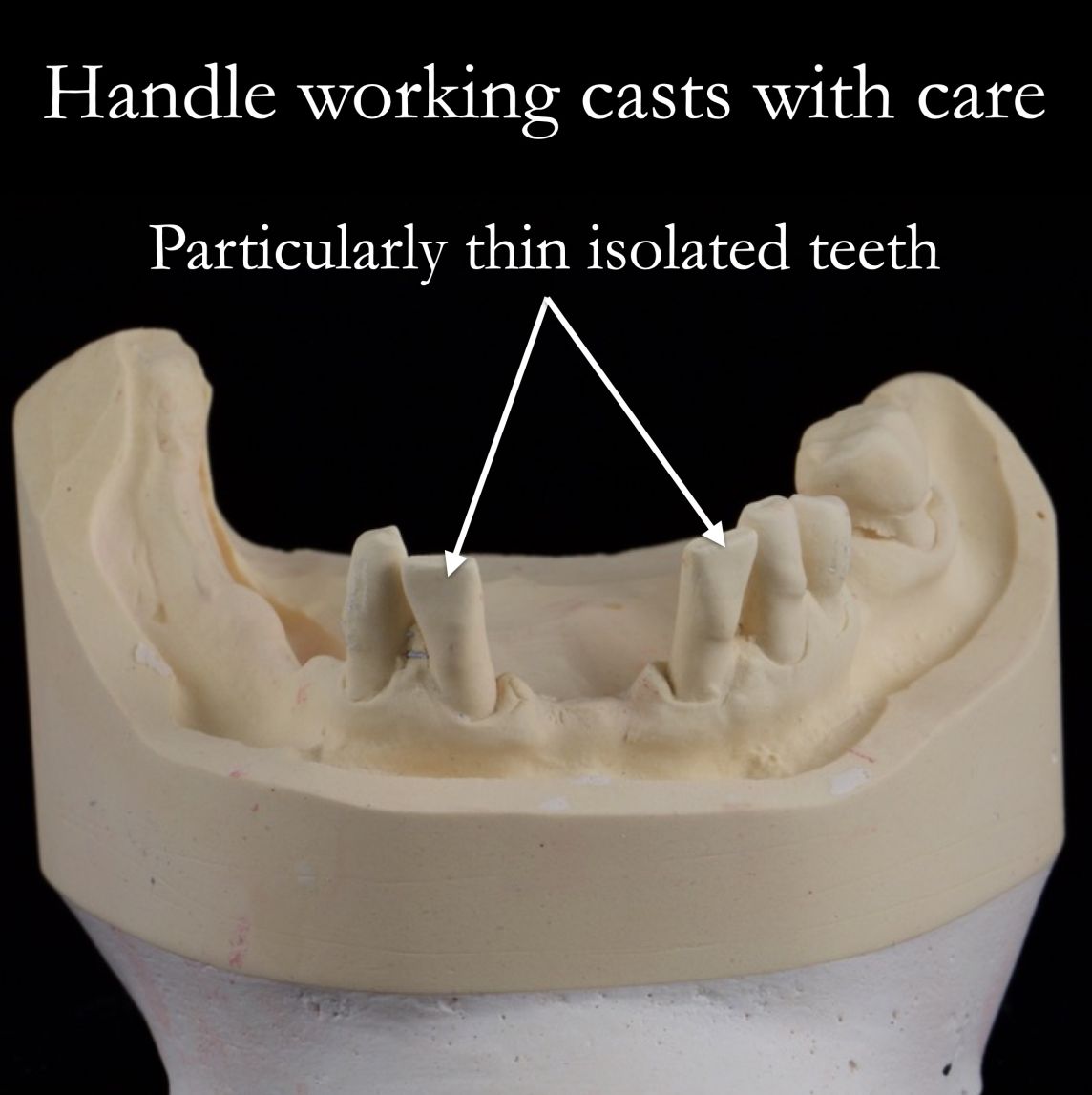 Handle working casts with care