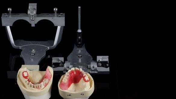Newsletter 86 Peter the Architect — precision removable partial dentures case study