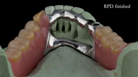 Ken – going downhill, first class