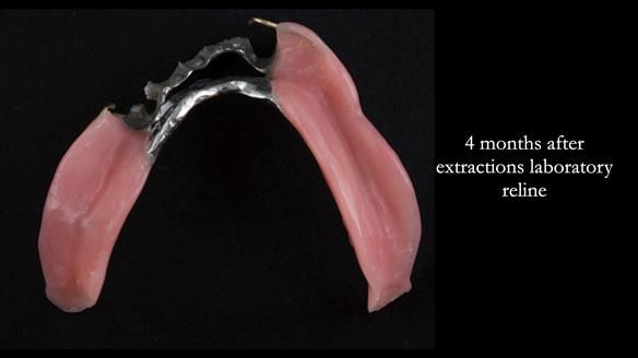 Ken – going downhill, first class