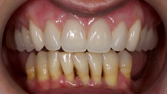 Newsletter 79 – Creating a wonderful smile and changing a life.