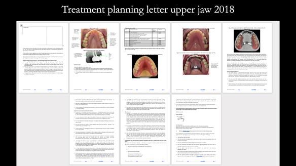 Ken – going downhill, first class