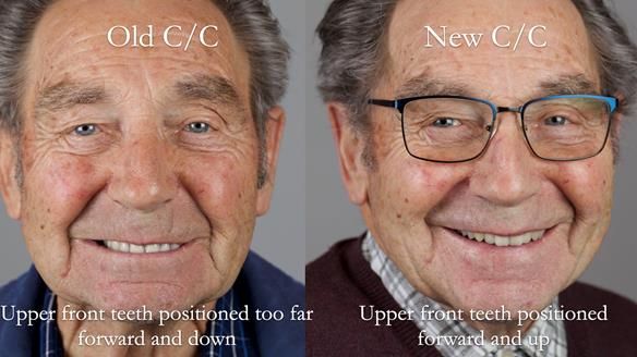 Newsletter 50 Special edition Complete Dentures FULL PROTOCOL