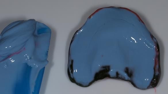 Newsletter 79 – Creating a wonderful smile and changing a life.