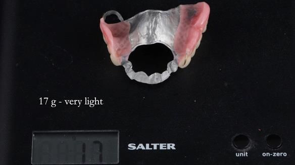 Finlay's Newsletter 60 Sylvia's upper Kennedy Class 2 Mod 1 metal based upper RPD