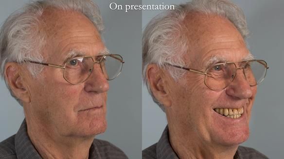 Ken – going downhill, first class