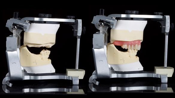 Newsletter 79 – Creating a wonderful smile and changing a life.