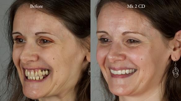 Newsletter 79 – Creating a wonderful smile and changing a life.