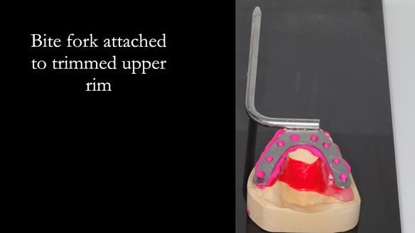 Finlay's Newsletter 60 Sylvia's upper Kennedy Class 2 Mod 1 metal based upper RPD