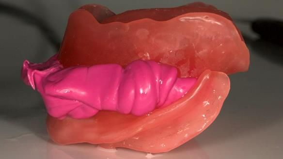 Primary jaw registration - used to mount the work casts to allow correct setting up of the central bearing apparatus - gothic arch tracing system