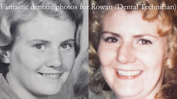 Replacing Madeline’s Complete denture FULL PROTOCOL