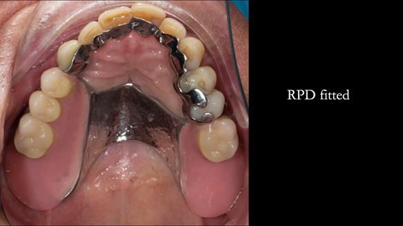 Ken – going downhill, first class