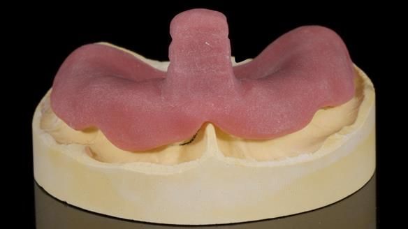 Newsletter 79 – Creating a wonderful smile and changing a life.