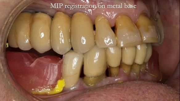 Ken – going downhill, first class