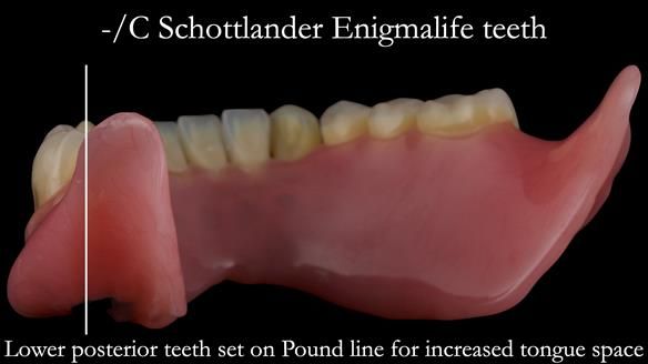 Newsletter 50 Special edition Complete Dentures FULL PROTOCOL