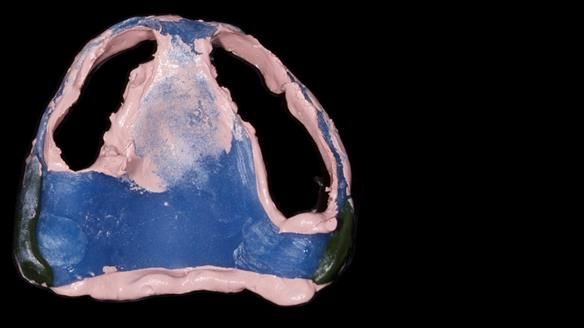 Newsletter 79 – Creating a wonderful smile and changing a life.