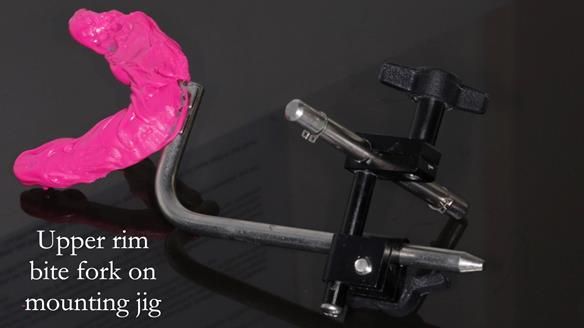 Finlay's Newsletter 58 Gasket upper partial denture for Zoe