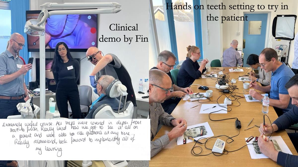 Finlay's Newsletter 64 case study - provision of a Kennedy class 2 metal based Scandinavian RPD for Ian