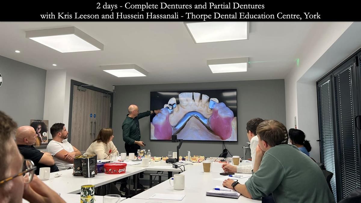 Finlay's Newsletter 59 Ultra hard partial dentures made for Gill