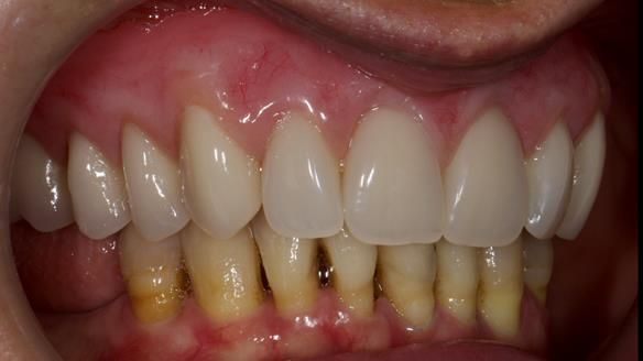 Newsletter 79 – Creating a wonderful smile and changing a life.