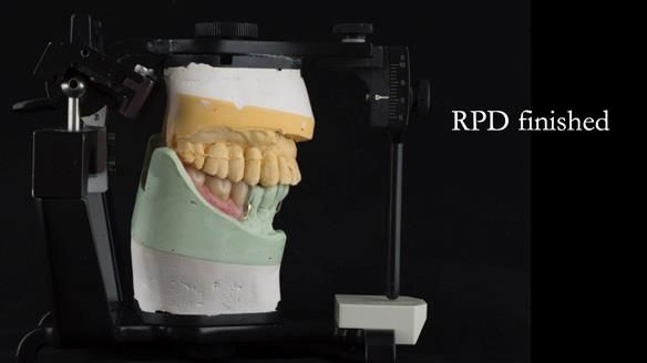 Ken – going downhill, first class