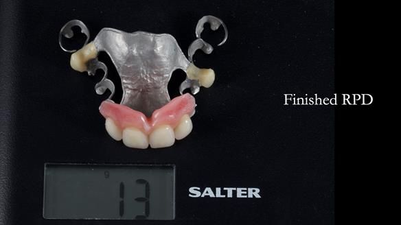 Newsletter 81 - Pam’s Story — how a partial denture changed her life (+ live walkthrough this Thursday)