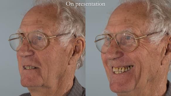 Ken – going downhill, first class