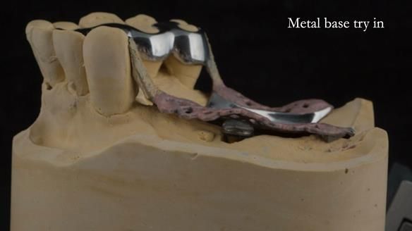 Ken – going downhill, first class