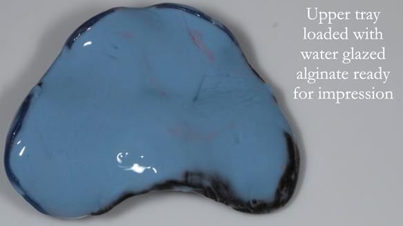 Finlay's Newsletter 58 Gasket upper partial denture for Zoe