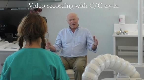 Complete denture Class II div 2 deep overbite Newsletter 39