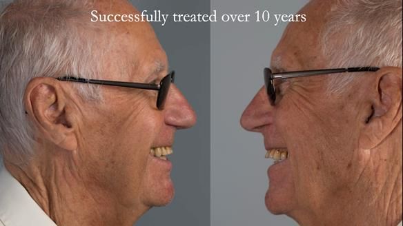 Ken – going downhill, first class