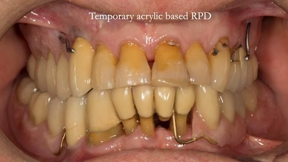 Ken – going downhill, first class