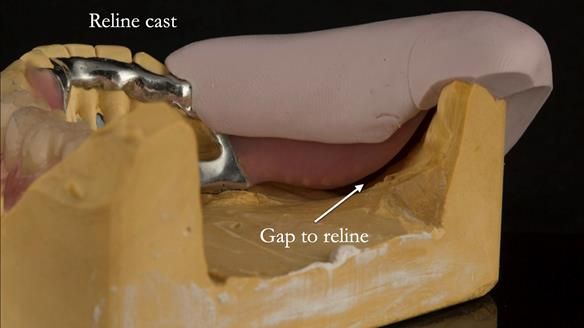 Ken – going downhill, first class