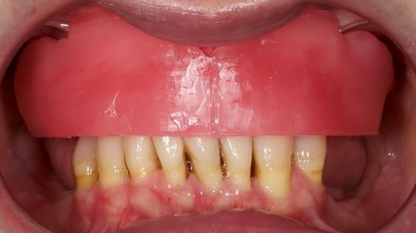 Newsletter 79 – Creating a wonderful smile and changing a life.