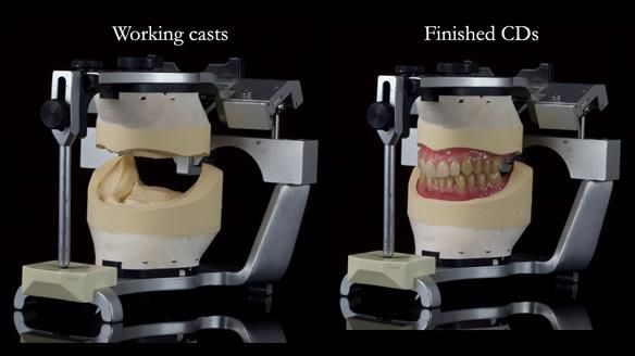 Newsletter 83: Sheila’s Complete Denture Success