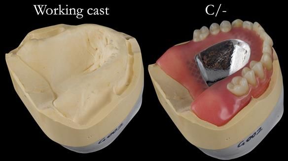 Newsletter 50 Special edition Complete Dentures FULL PROTOCOL