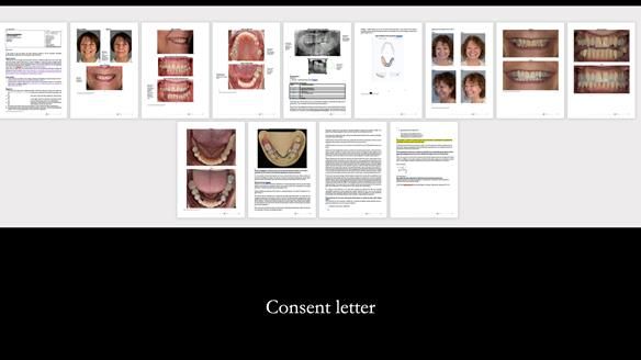 Finlay's Newsletter 61 provision of a lower unilateral free end saddle metal based partial denture for Joyce
