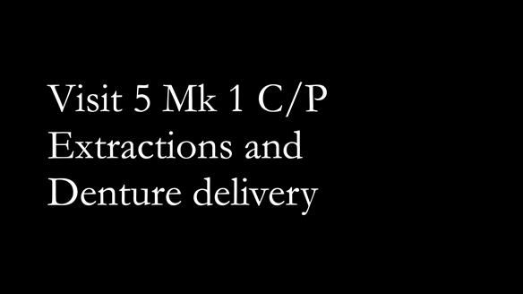 Newsletter 52 Managing Jo’s failing dentition with extractions and Mk 1/Mk 2 complete upper dentures and lower partial dentures FULL PROTOCOL