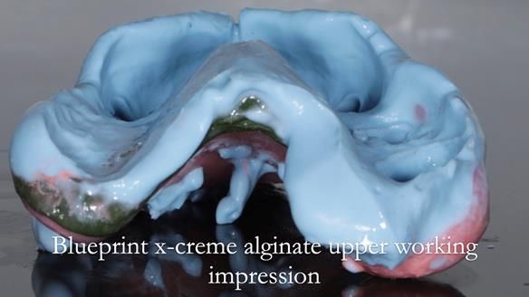 Finlay's Newsletter 60 Sylvia's upper Kennedy Class 2 Mod 1 metal based upper RPD