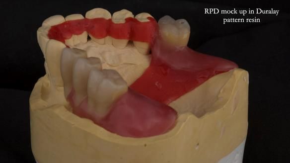 Ken – going downhill, first class