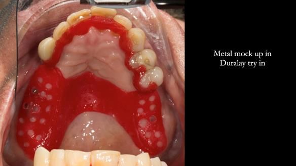 Ken – going downhill, first class