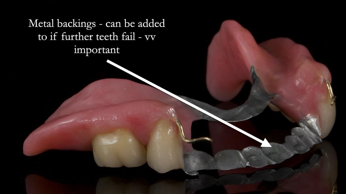 Newsletter 87 – Father Peter: A Partial Denture that needed Minor Miracle