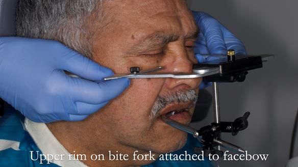 Finlay's Newsletter 62 provision of extractions and metal based complete dentures for Rafique