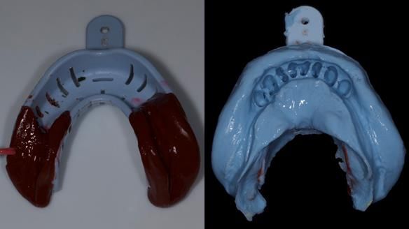 Newsletter 79 – Creating a wonderful smile and changing a life.