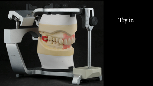 Figure 64 Definitive casts mounted on Denar Mk 2 articulator. Teeth try in on pattern resin bases
