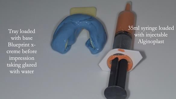 Newsletter 75: Marion’s case - Step-by-step complete denture workflow